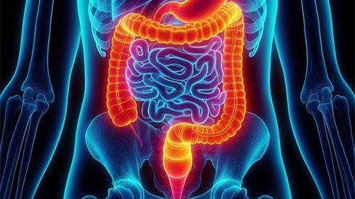 La gestione delle malattie infiammatorie croniche intestinali