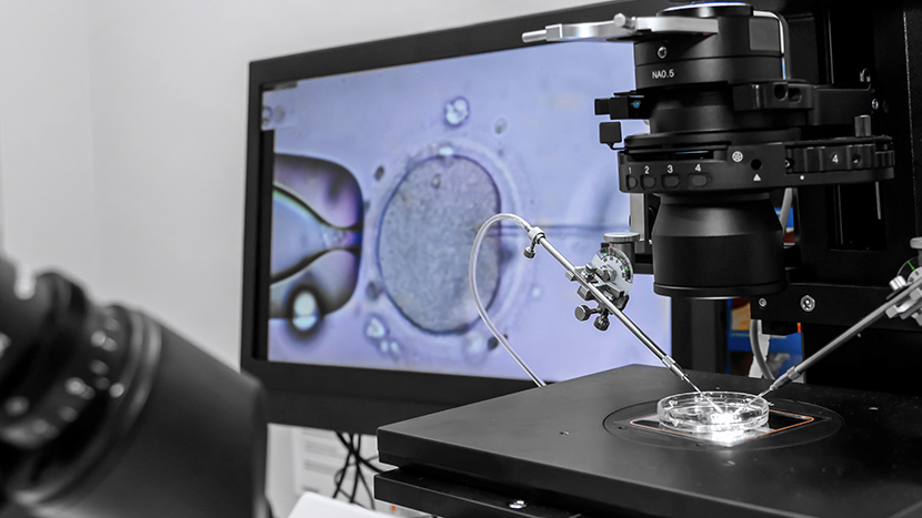 La medicina riproduttiva accelera verso una gestione sempre più digitale e personalizzata della fertilità. In Italia nasce MeggyCare, prima start-up dedicata all’autoconservazione degli ovociti: una piattaforma che facilita l’accesso al social freezing e promuove maggiore consapevolezza sul potenziale riproduttivo femminile, accompagnando le donne in un percorso informativo e clinico strutturato.
Sul fronte dell’infertilità maschile severa, il Columbia university fertility center ha documentato la prima gravidanza clinica ottenuta grazie alla tecnologia Star (Sperm tracking and recovery). Il sistema, basato su imaging ad alta velocità e algoritmi di intelligenza artificiale, consente di individuare e recuperare spermatozoi vivi anche nei casi di azoospermia non ostruttiva, offrendo nuove prospettive terapeutiche rispetto ai tradizionali interventi di recupero chirurgico.