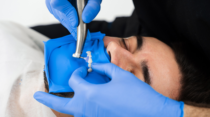 L’uso della diga di gomma nella pratica clinica quotidiana