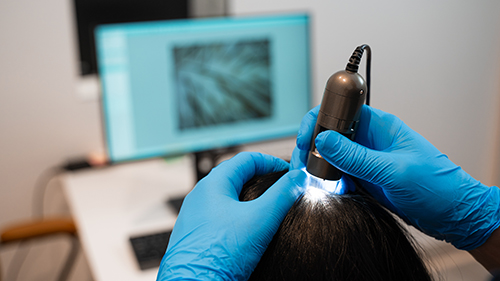 Integrated health in tricologia: dalla diagnosi alla terapia