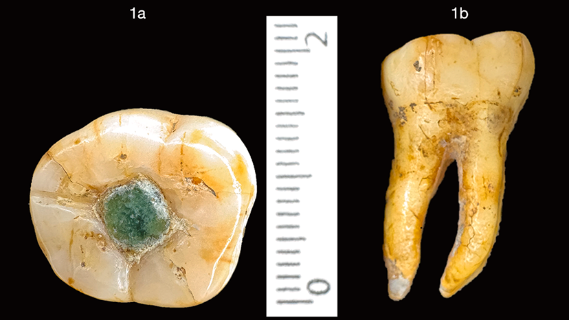Dentista maya_830